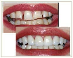 Slider image (8) Bangkok Dental Image